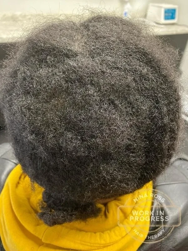 After treatment